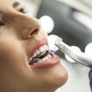 Igiene Professionale | Pulizia dei Denti