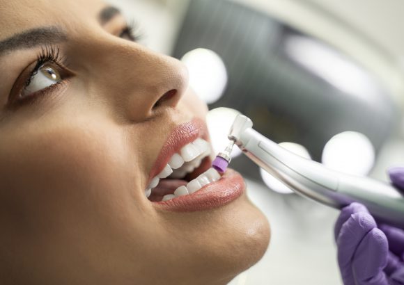 Igiene Professionale | Pulizia dei Denti